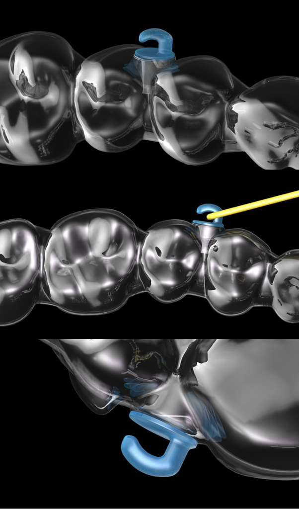 Product pictures angelHook